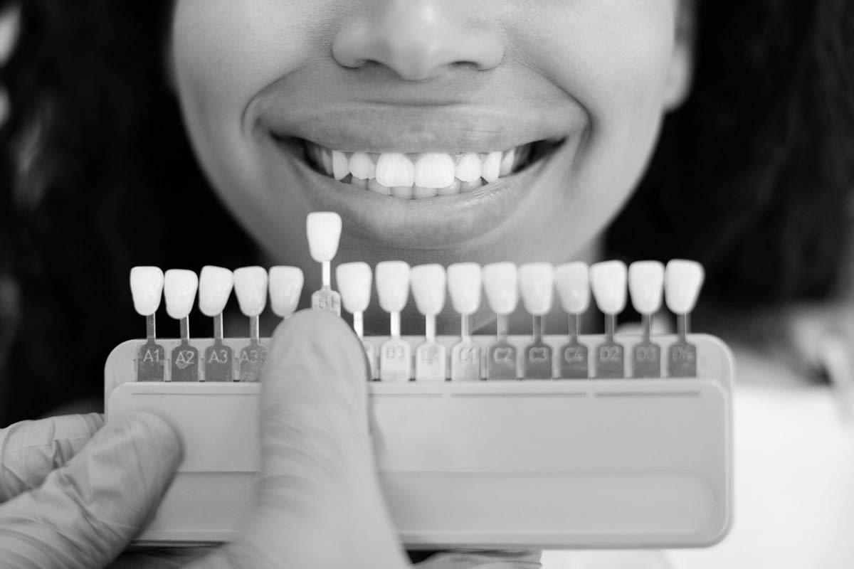 woman choosing a color for dental veneers during her visit to Smiles on Elston