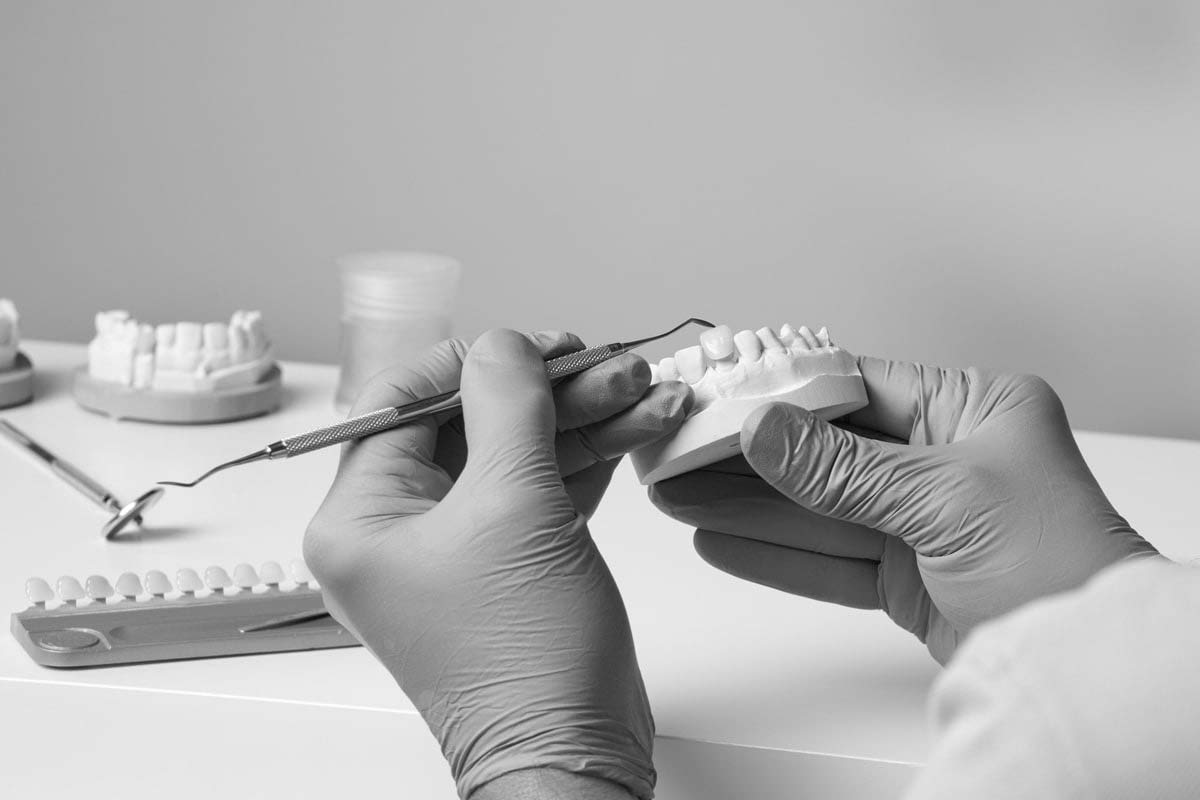 teeth model showing how dentists can restore smiles