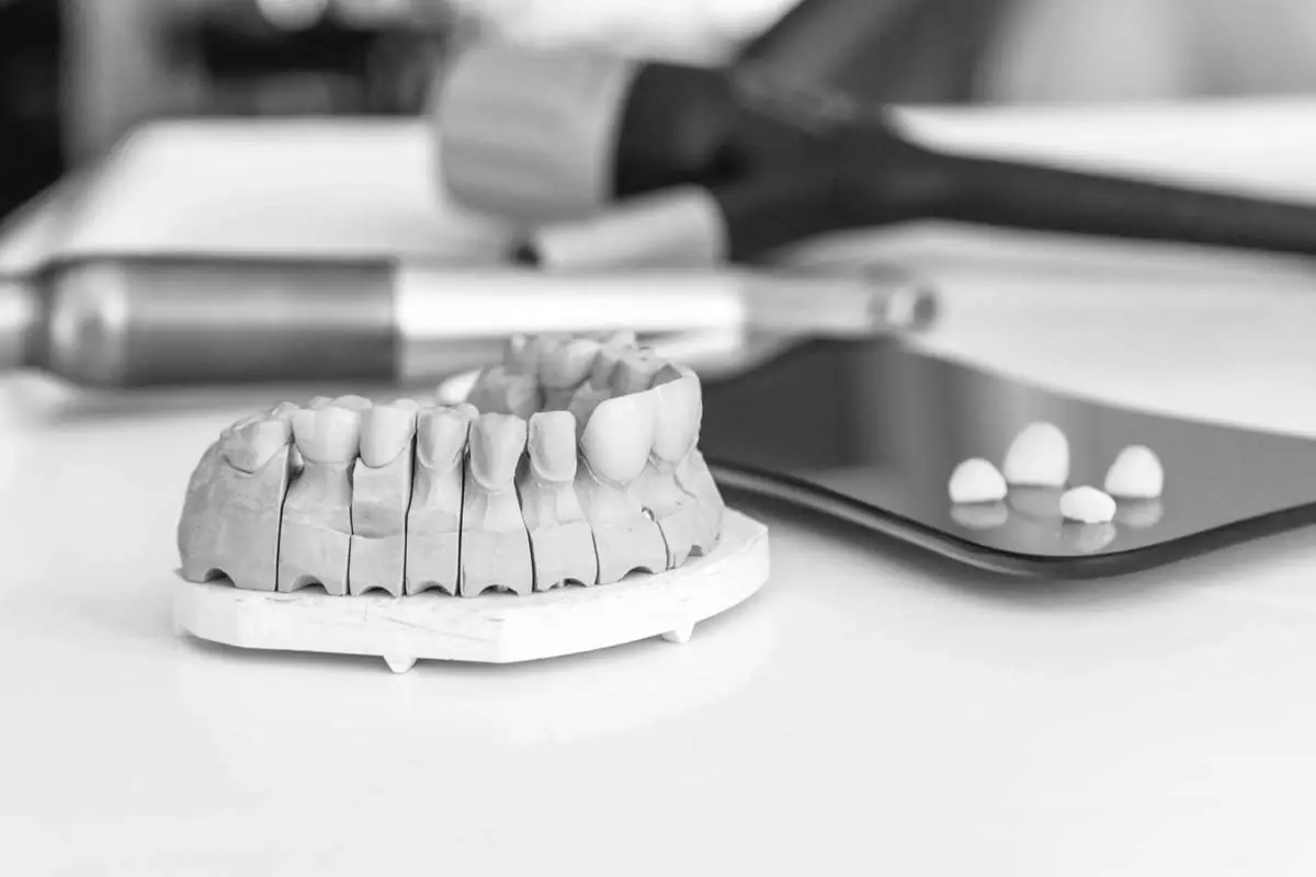 model of teeth that dentists use to teach dental care