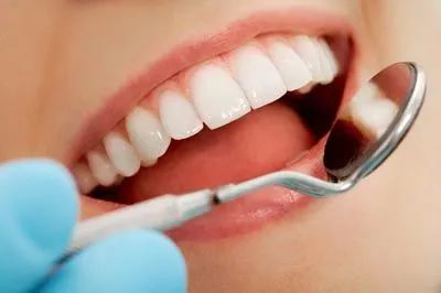 closeup of a patient getting a dental checkup at Smiles on Elston
